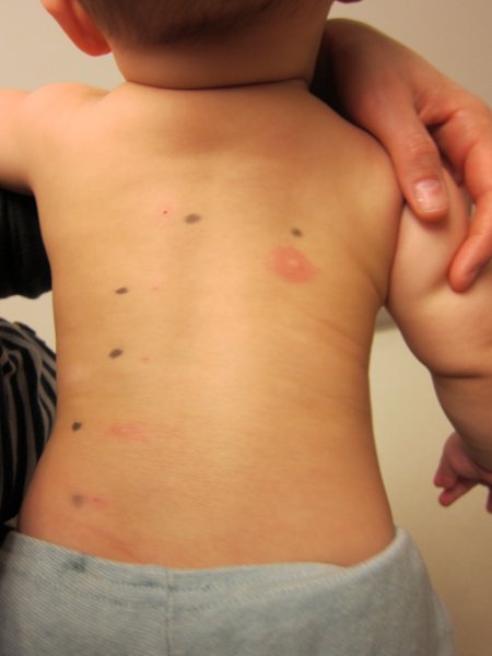 Fotó: https://shotgunkorea.files.wordpress.com/2012/04/img_1918.jpg